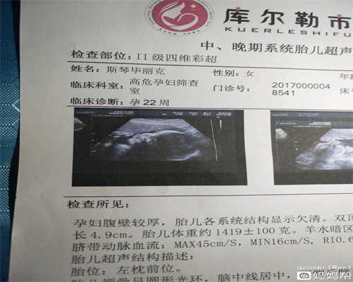 广州取卵做代孕费用_广州代孕需要多久_世纪助孕公司：1岁宝宝有多动症怎么办
