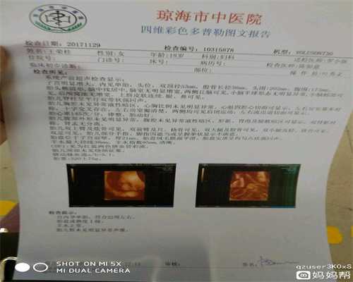 广州哪里的代孕医院好_广州代孕费用高不高_上海代妈助孕：卵巢早衰如何备孕