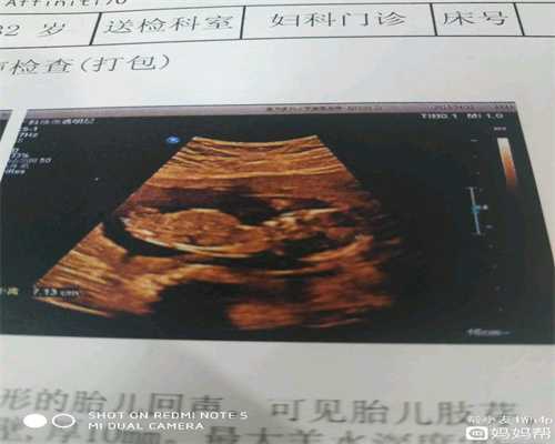 广州哪家医院代孕费用低_广州代孕套餐服务_广州宝贝孕国际试管：怀孕期间导
