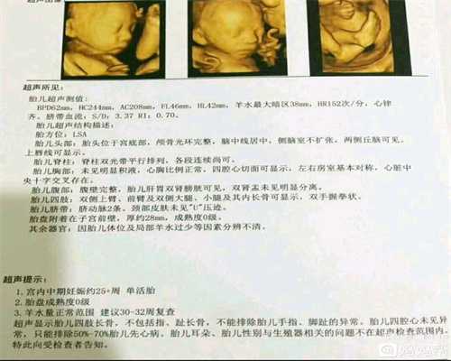 广州代孕费用包成功_广州代孕一个大概多少钱_爱维艾夫医院：取环没多久怀孕