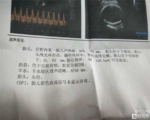 广州代孕能选择性别吗_广州代孕个人_东方辅助生殖集团：武汉3名孕妇在家土法