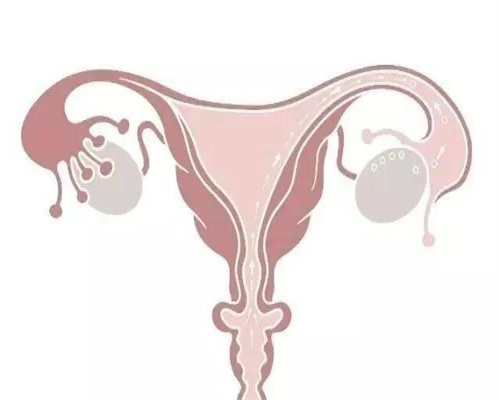 广州分享我的代孕经历_广州代孕产子的好处_加州医学中心：子宫内膜异位症的