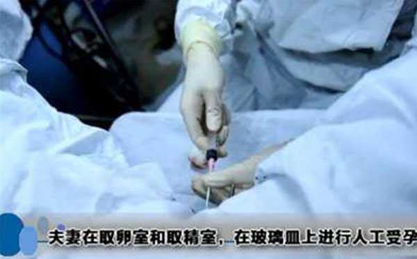 祁阳县精贝助孕公司_祁阳县最好的助孕机构_试管婴儿手术取卵是不是很疼，打